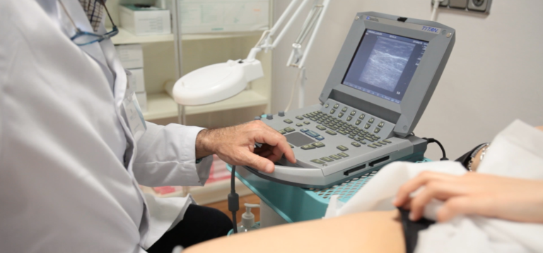 La escleroterapia en 5 puntos