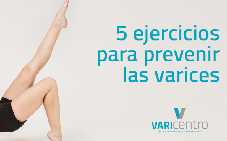 Cinco ejercicios para prevenir las varices en los pies Cinco ejercicios para prevenir las varices en los pies