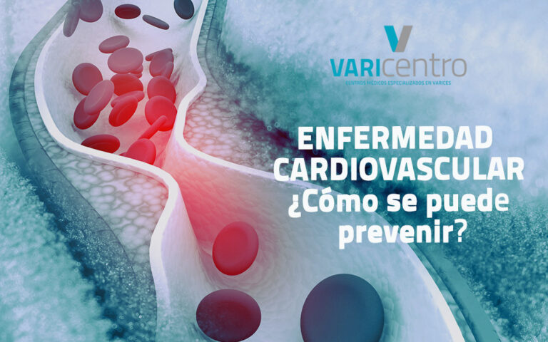 enfermedad cardiovascular