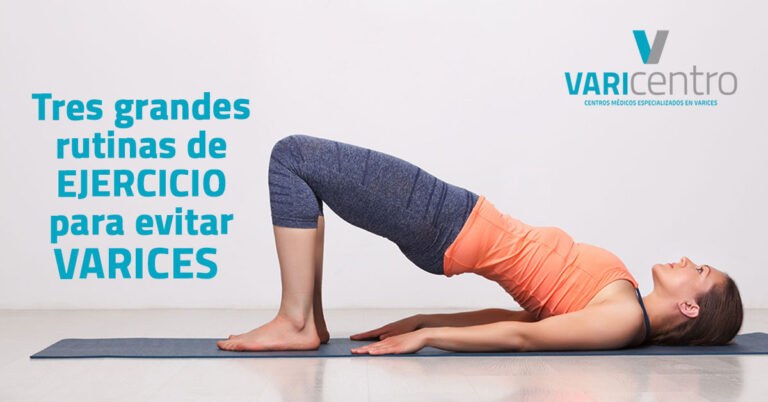 Las tres grandes rutinas para evitar varices Las tres grandes rutinas para evitar varices