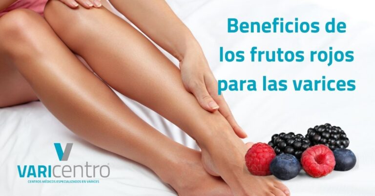 Los beneficios de los frutos rojos para las varices Los beneficios de los frutos rojos para las varices