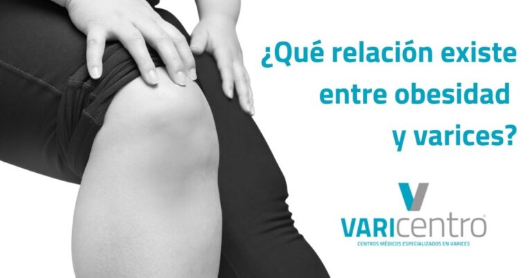 Relación entre obesidad y varices Relación entre obesidad y varices