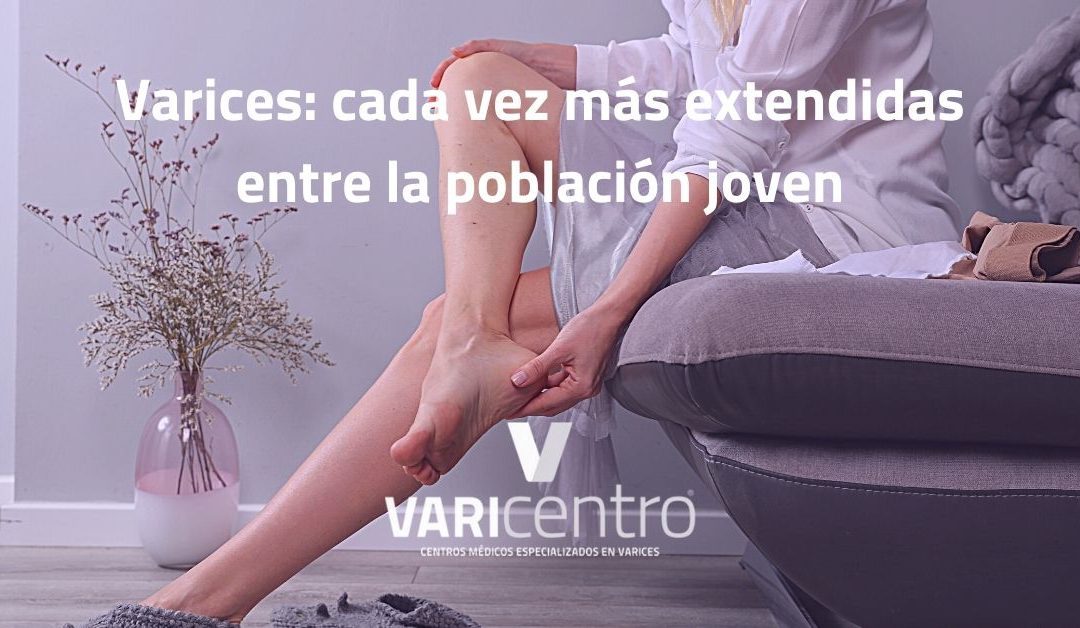 Varices: cada vez más extendidas entre la población joven