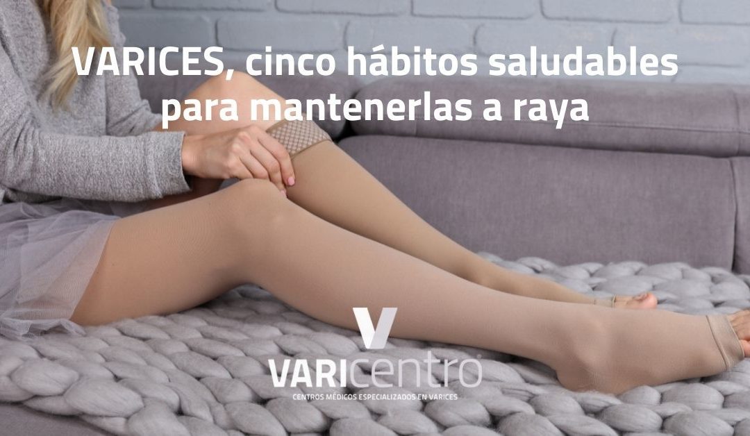 Varices; cinco hábitos saludables para mantenerlas a raya