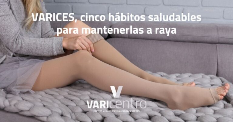 Varices; cinco hábitos saludables para mantenerlas a raya