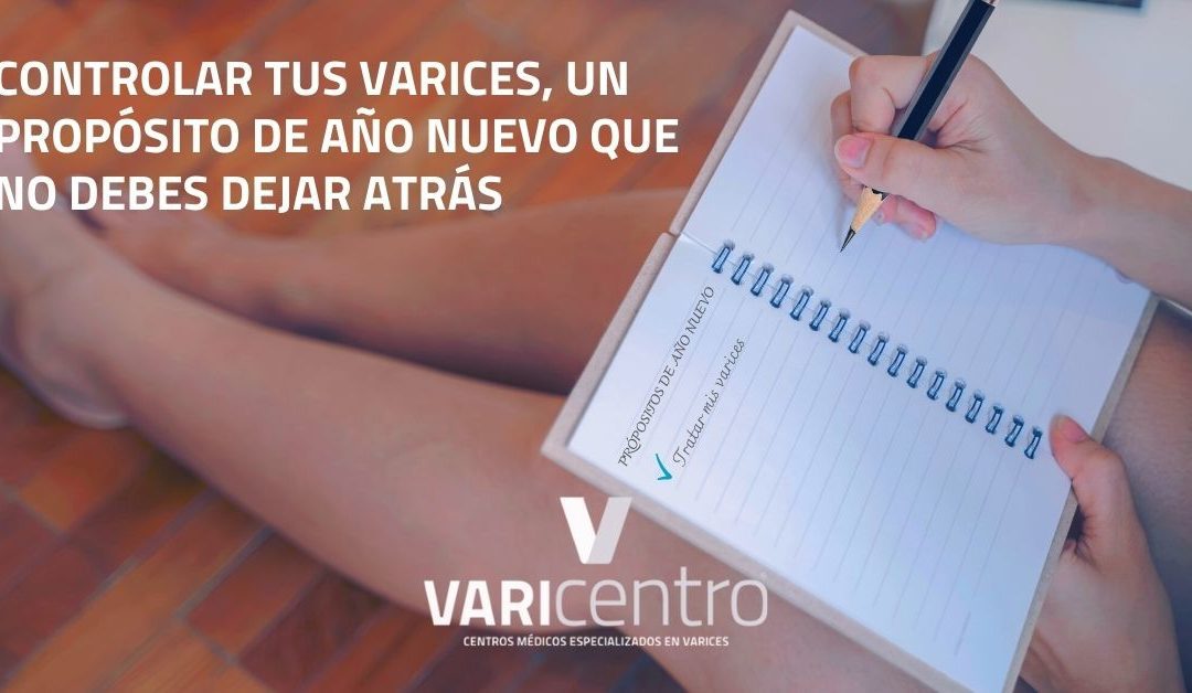 Controlar tus varices, un propósito de año nuevo que no debes dejar atrás