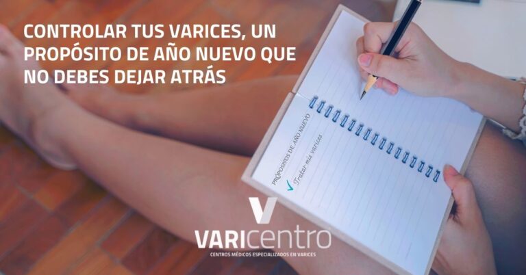 Controlar tus varices, un propósito de año nuevo que no debes dejar atrás