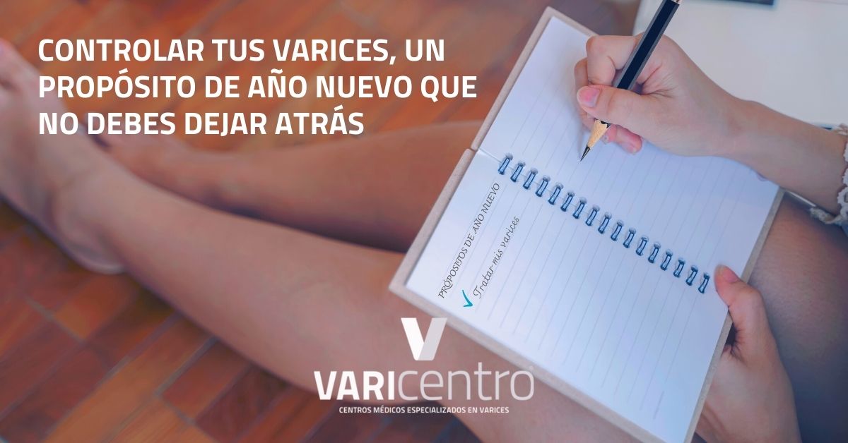 Controlar tus varices, un propósito de año nuevo que no debes dejar atrás