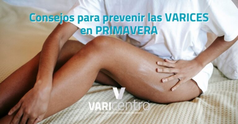 Varices en primavera