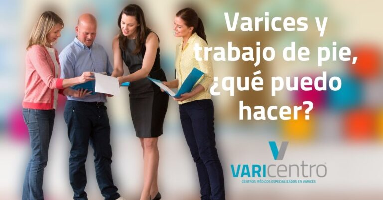 varices y trabajar de pie