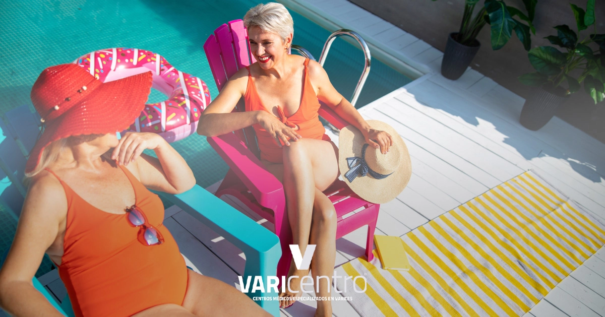 Evita estas 3 cosas en verano para que no empeoren tus varices 