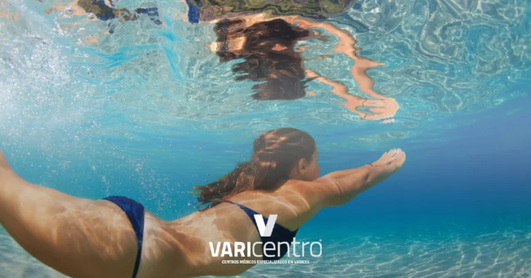 Deportes que puedes practicar en verano si tienes varices Ejercicios para varices en verano