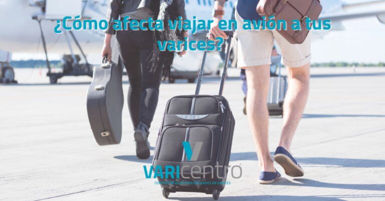 ¿Cómo afecta viajar en avión a tus varices?