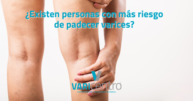 ¿Existen personas con más riesgo de padecer varices?&nbsp;