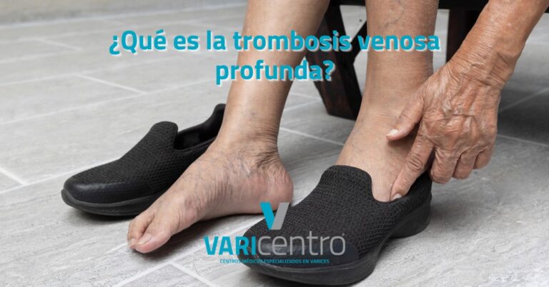 ¿Qué es la trombosis venosa profunda?