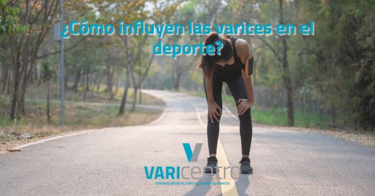 ¿Cómo influyen las varices en el deporte? ¿Cómo influyen las varices en el deporte?