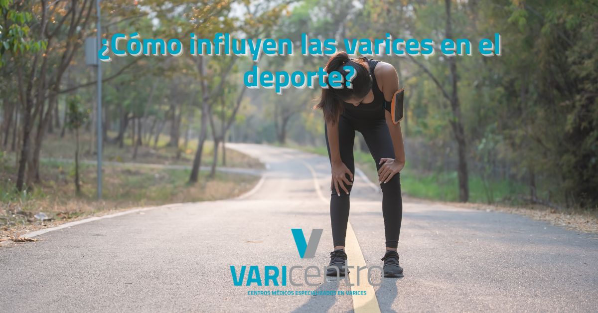 ¿Cómo influyen las varices en el deporte?