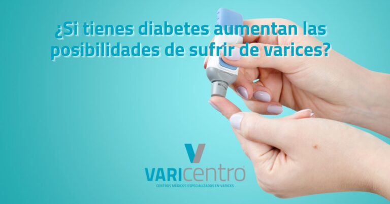 ¿Si tienes diabetes aumentan las posibilidades de sufrir de varices?