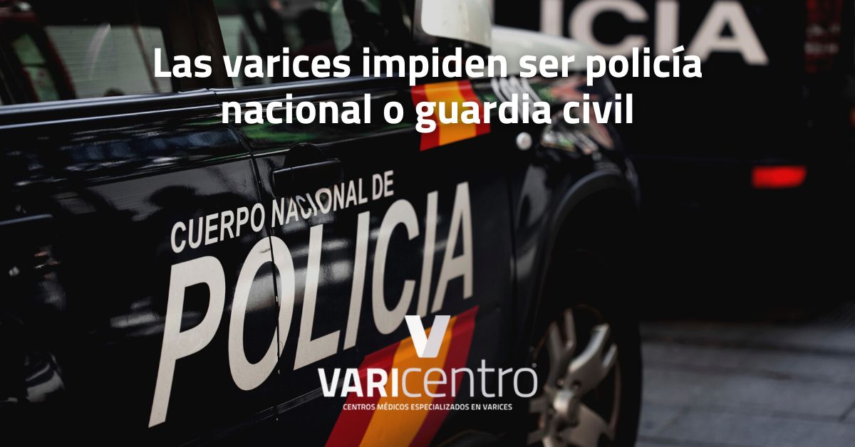 Las varices entre los criterios de exclusión para acceder a las fuerzas y cuerpos de seguridad del estado