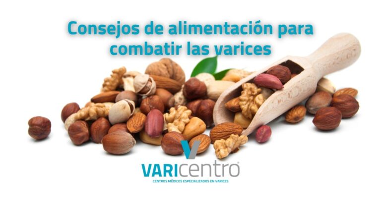 Destacando mitos y realidades sobre las varices en verano