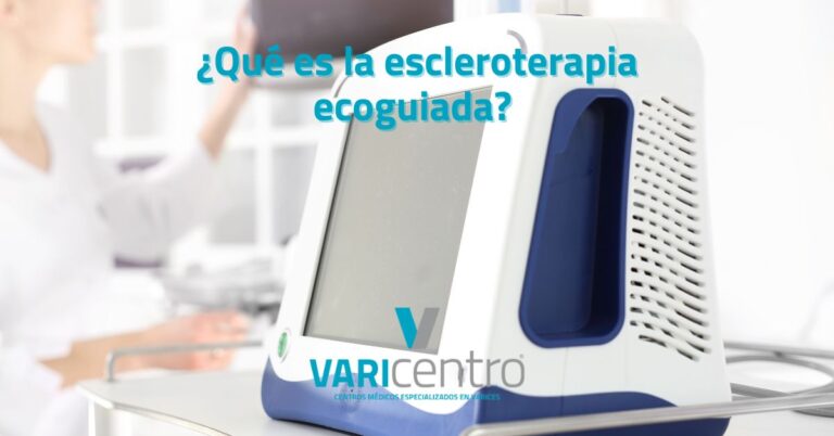 Cómo prevenir las varices en verano durante los viajes en coche