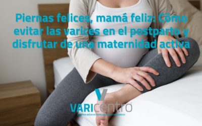 Piernas felices, mamá feliz: Cómo evitar las varices en el postparto y disfrutar de una maternidad activa