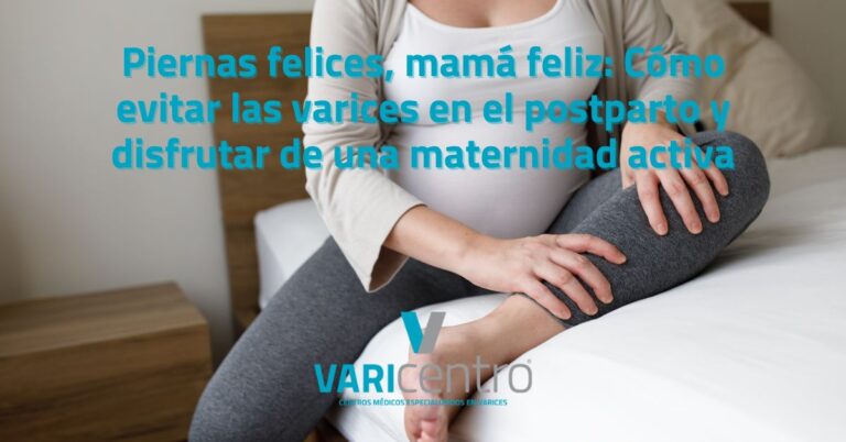Piernas felices, mamá feliz: Cómo evitar las varices en el postparto y disfrutar de una maternidad activa