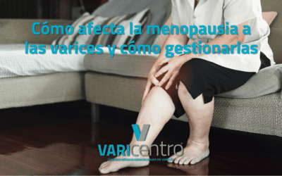 Cómo afecta la menopausia a las varices y cómo gestionarlas