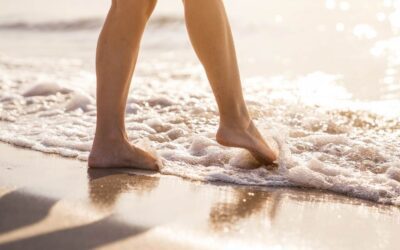 7 estrategias para controlar las varices durante el verano