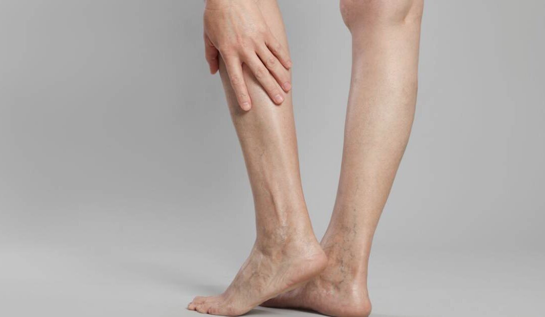 7 señales tempranas de mala circulación y cómo actuar a tiempo