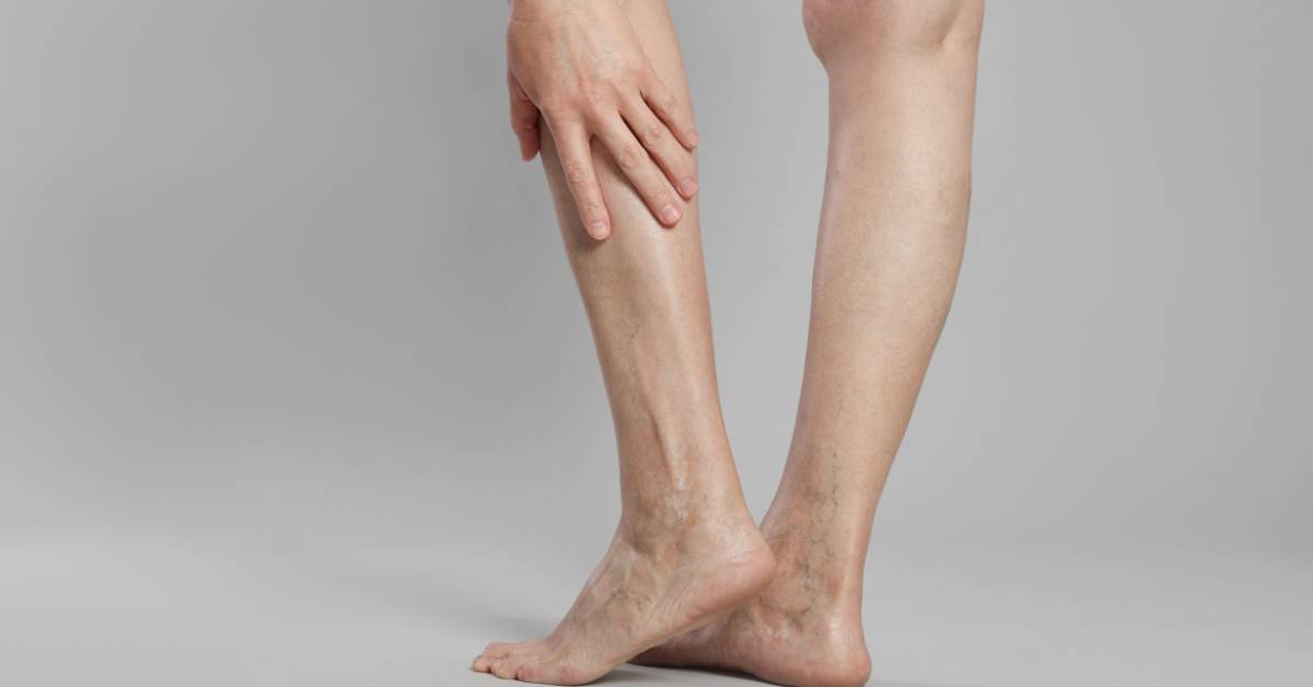 7 Señales Tempranas De Mala Circulación Y Cómo Actuar A Tiempo