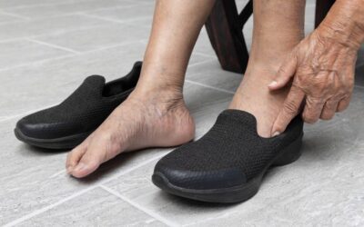 6 consejos para elegir el calzado adecuado y prevenir las varices
