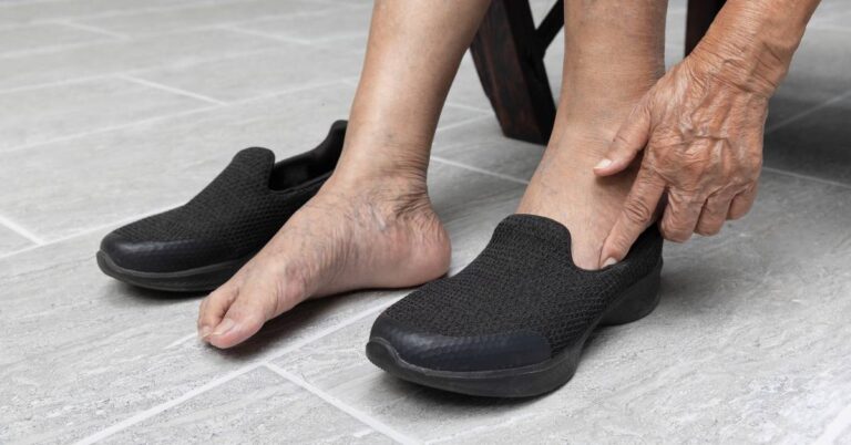 El calzado es muy importante para prevenir las varices