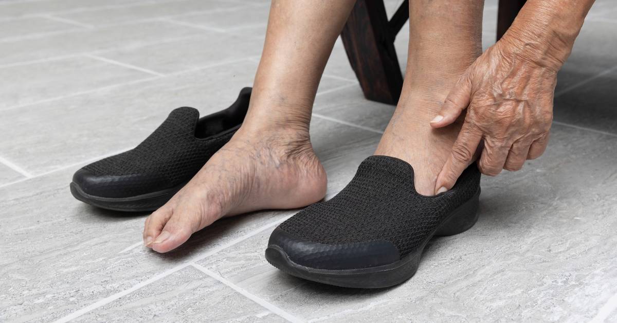 El calzado es muy importante para prevenir las varices