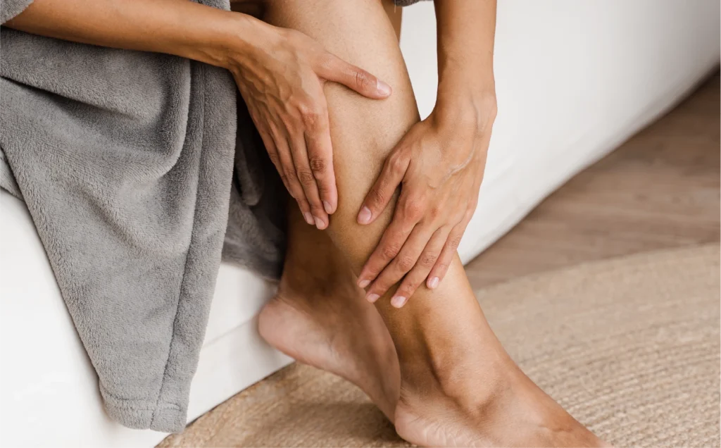 Varices en jóvenes