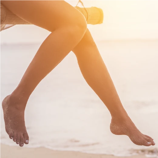Cómo prevenir las varices