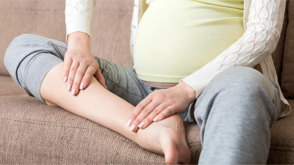Varices en la mujer y embarazo