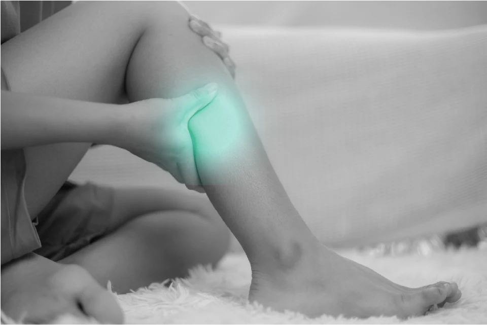 Síntomas de las varices